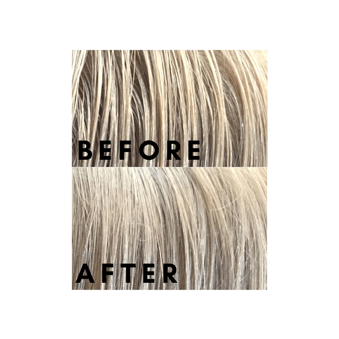 Scalpfix™ - Image 3